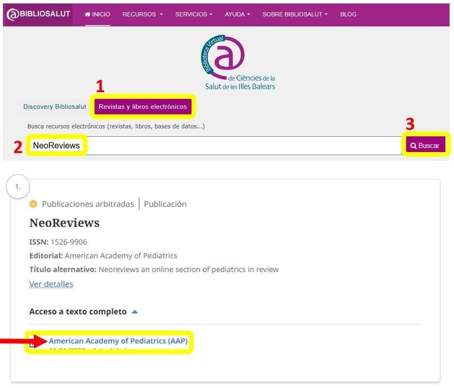 acceso neo reviews ES