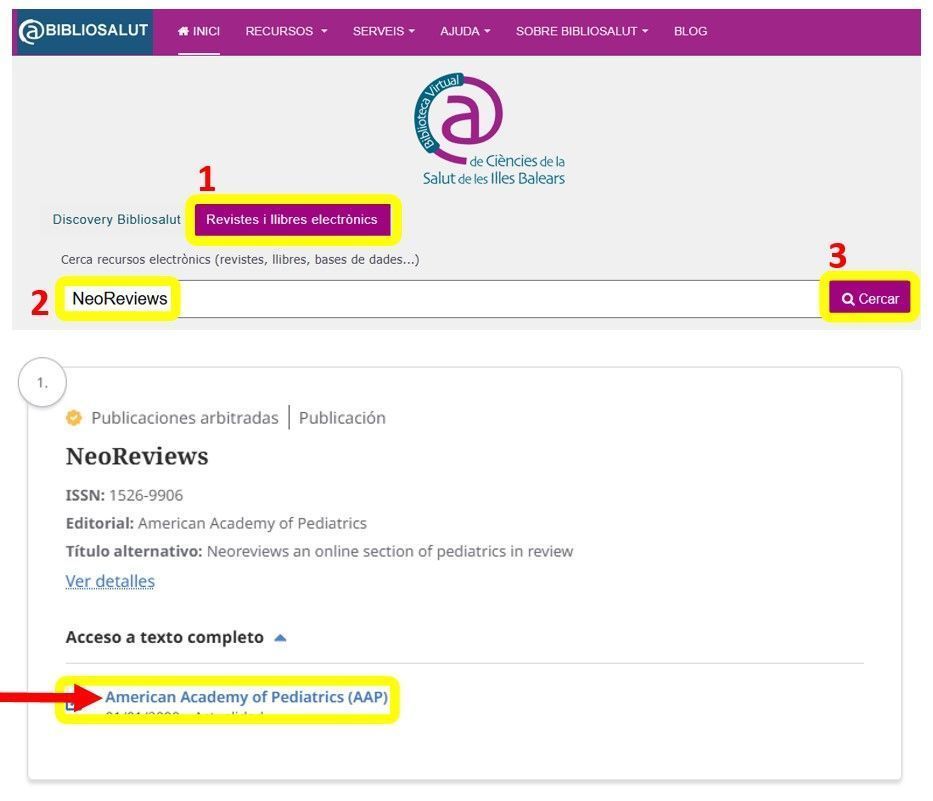 acceso neo reviews 