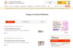 Images in Clinical Medicine