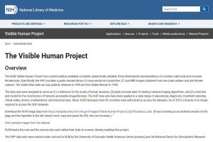 The Visible Human Project