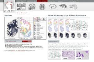 The Human Brain Atlas